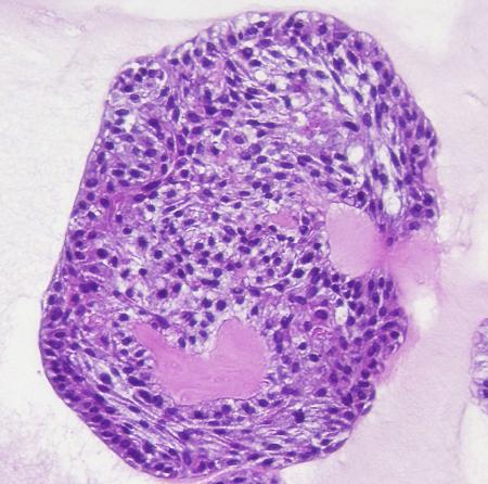 京都大iPS細胞研究所などのチームが作製したミニ気管支(同研究所提供)